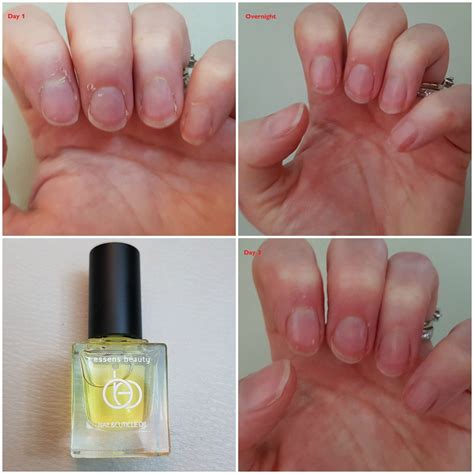 How to get rid of ragged dry cuticles | Grow nails faster, Nails, Nail ...