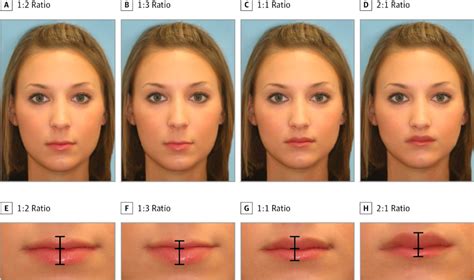 The Most Beautiful Female Lips; Study Finds 1:2 Ratio Is Most ...