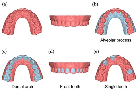 Alveolar Arch