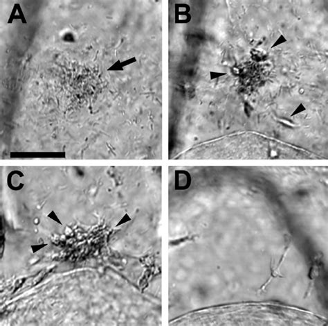 Time course of behavior revealed by mesenchyme cells in response to B ...