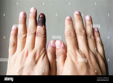 Index finger with indelible ink stain after voting in election Stock ...