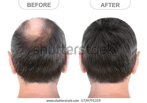 view male head   stock photo edit