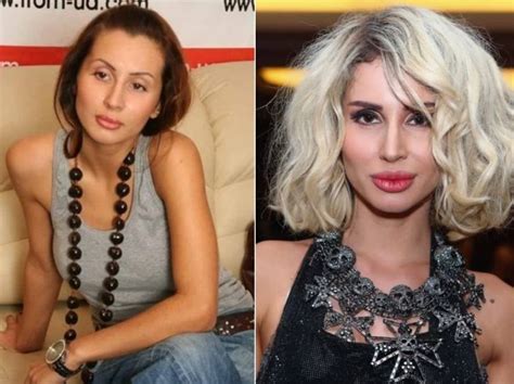 Светлана Лобода до и после пластических операций