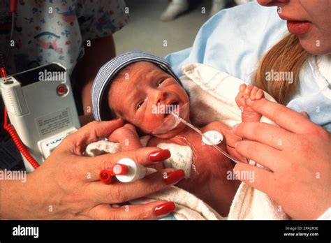 Premature baby with a breathing tube. The lungs must still develop ...