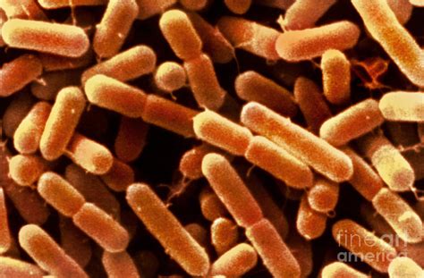Listeria Monocytogenes Photograph by Scimat - Pixels