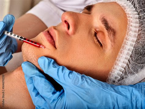 Foto Stock Filler injection for male forehead face. Plastic aesthetic ...