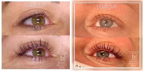 What is Eyelash Lift? - Cost, Aftercare & Benefits