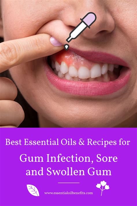 how to soothe gum pain 4