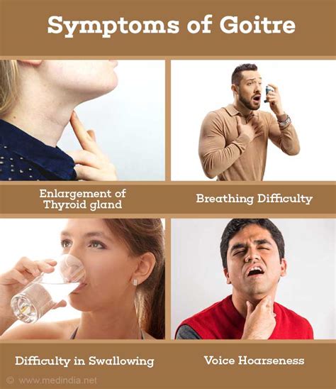 symptoms   goitre goiter  types  treatment uytt