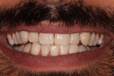 Dental Hygienist Droitwich | Expert Care at Droitwich Dental Studio