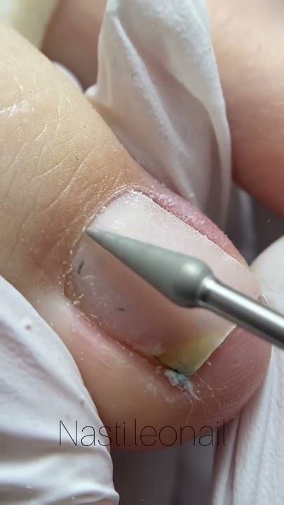 Педикюр / тампонада / покрытие лаком #pedicure #nails #pedicura #ногти ...