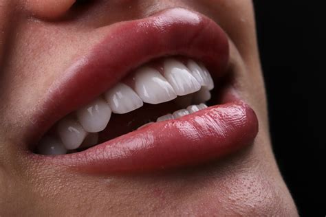Cosmetic dentistry - مركز السنابل للأسنان