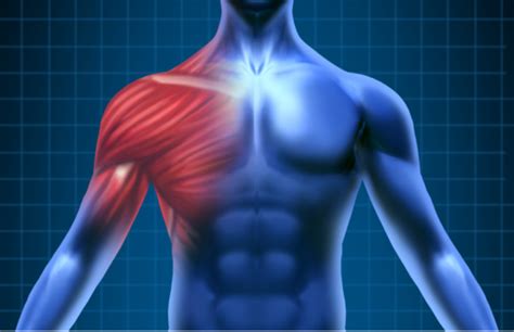 Shoulder pain – big pain or small problem? - The Bodyworks Clinic ...