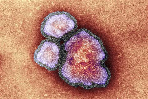 Measles | Page 2 | DIYnot Forums