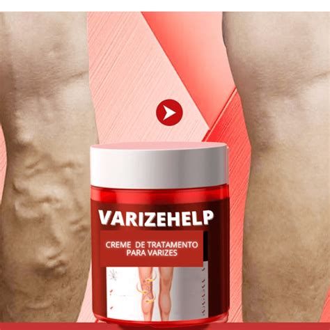 O Que Bom Para Varizes - Creme Para Varizes Efeito Imediato VarizeHelp – Saúde no Cotidiano