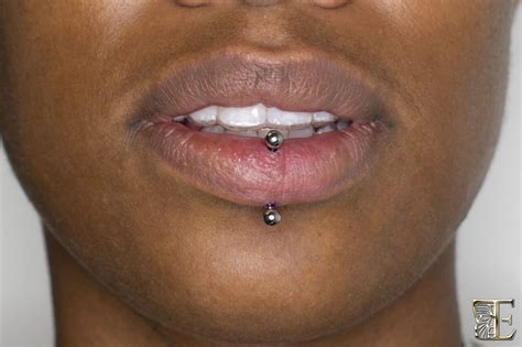 Vertical Labret Piercing Swelling Collectisale | instrumentation.kmitl ...