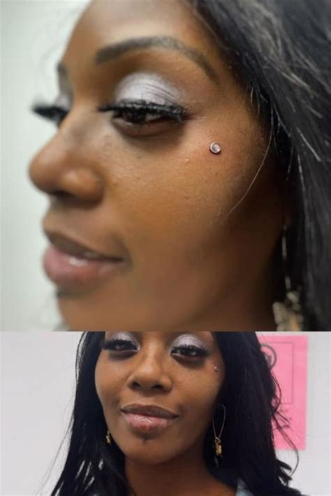 perfect upper cheek dermal piercing