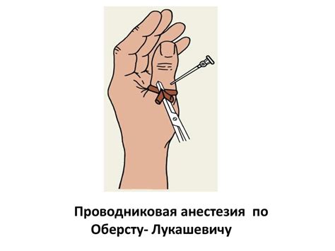 Местное обезболивание - презентация онлайн