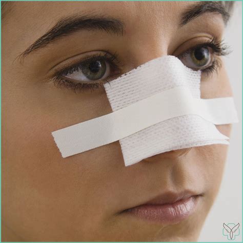 how to know if nose is broken 8