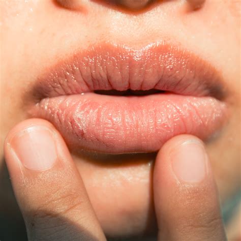 dehydrated lips   infoupdateorg