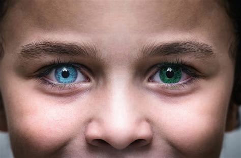 Central Heterochromia: Definition and Causes - All About Vision